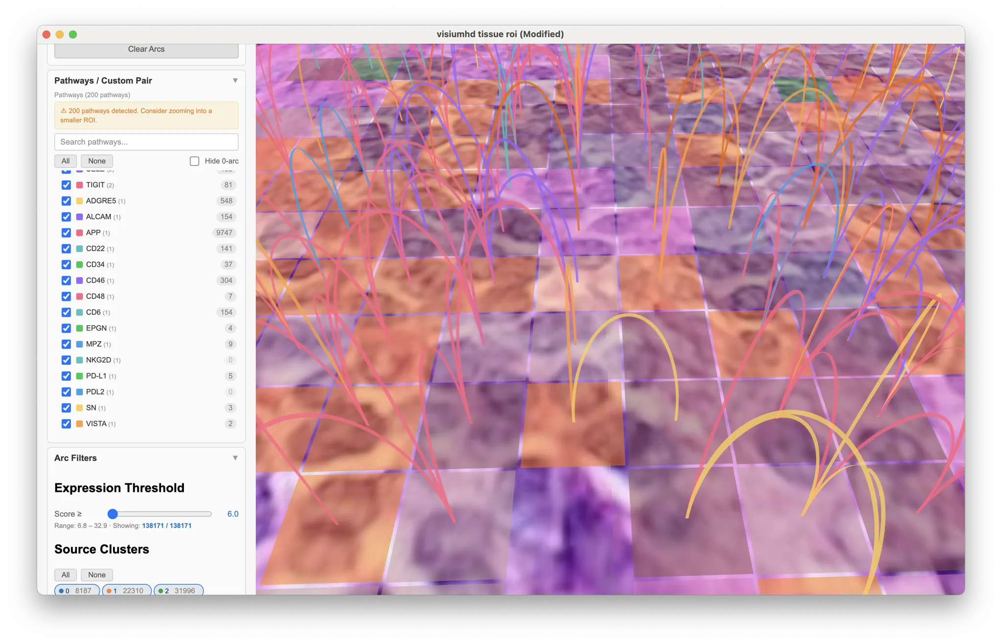 ArcScape rendering of a Visium HD human colorectal cancer section: pathway arcs generated for the current region of interest over a high-resolution HE background on a fine binned grid.